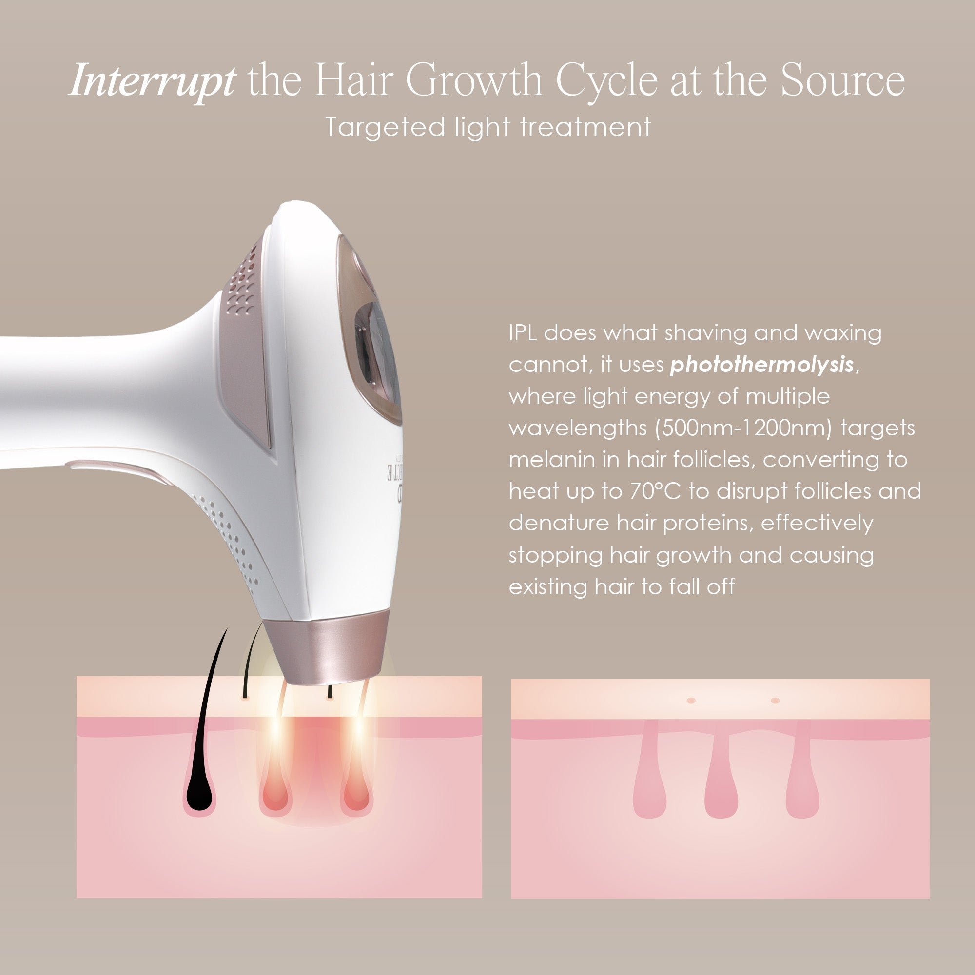 SmoothPro+ hair removal device showing skin infographic on how targeted hair treatment works to reduce hair growth